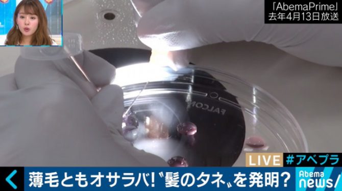 2020年には薄毛治療に革新？日本の再生医療技術がついに"髪のタネ"を発明